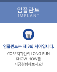 임플란트