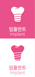 임플란트