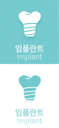임플란트