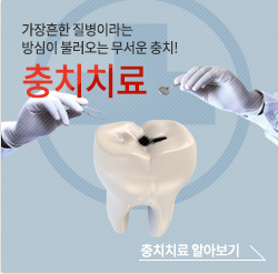 충치치료