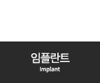 임플란트