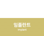 임플란트