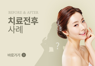 치료전후사례