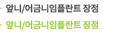 앞니/어금니 임플란트 장점