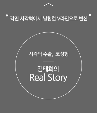 각진 사각턱에서 날렵한 V라인으로 변신, 사각턱 수술, 코성형. 김태희의 리얼스토리