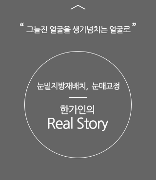 각진 사각턱에서 날렵한 V라인으로 변신, 사각턱 수술, 코성형. 김태희의 리얼스토리