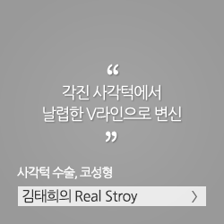 각진 사각턱에서 날렵한 V라인으로 변신, 사각턱 수술, 코성형. 김태희의 리얼스토리