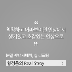 각진 사각턱에서 날렵한 V라인으로 변신, 사각턱 수술, 코성형. 김태희의 리얼스토리