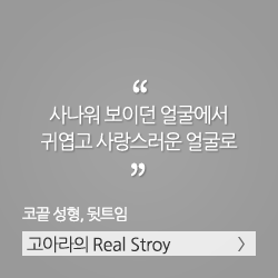 각진 사각턱에서 날렵한 V라인으로 변신, 사각턱 수술, 코성형. 김태희의 리얼스토리