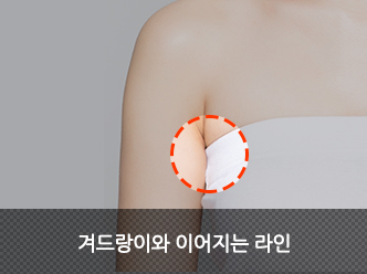 겨드랑이와 이어지는 라인