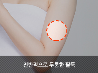 전반적으로 두툼한 팔뚝