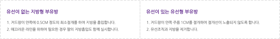 유선이 없는 지방형 부유방: 1. 겨드랑이 안쪽에 0.5cm 정도의 최소절개를 하여 지방을 흡입합니다. 2. 매끄러운 라인을 위하여 필요한 경우 팔의 지방흡입도 함께 실시합니다. 유선이 있는 유선형 부유방:1. 겨드랑이 안쪽 주름 1cm를 절개하여 절개선이 노출되지 않도록 합니다. 2. 유선조직과 지방을 제거합니다.