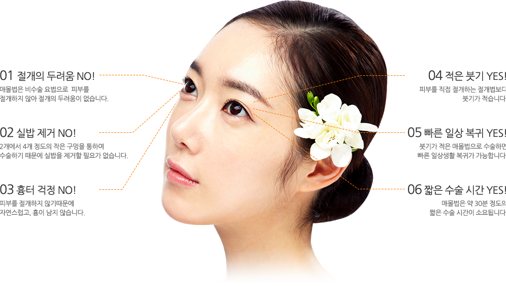01 절개의 두려움 NO! 매몰법은 비수술 요법으로  피부를
절개하지 않아 절개의 두려움이 없습니다. 02 실밥 제거 NO! 2개에서 4개 정도의 작은 구멍을 통하여
수술하기 때문에 실밥을 제거할 필요가 없습니다. 03 흉터 걱정 NO! 피부를 절개하지 않기때문에
자연스럽고, 흉이 남지 않습니다. 04 적은 붓기 YES! 피부를 직접 절개하는 절개법보다
붓기가 적습니다. 05 빠른 일상 복귀 YES! 붓기가 적은 매몰법으로 수술하면
빠른 일상생활 복귀가 가능합니다. 06 짧은 수술 시간 YES! 매몰법은 약 30분 정도의
짧은 수술 시간이 소요됩니다.