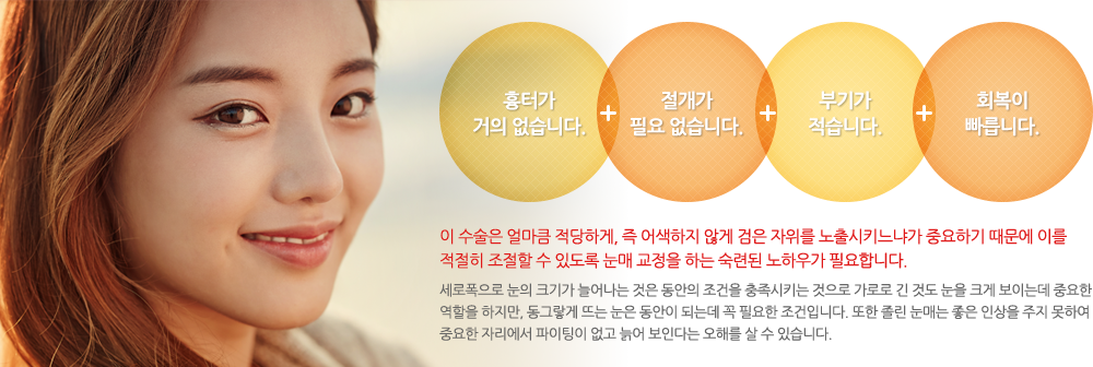 1.흉터가 거의 없습니다. 2. 절개가 필요 없습니다. 3. 부기가 적습니다. 4. 회복이 빠릅니다. 
이 수술은 얼마큼 적당하게, 즉 어색하지 않게 검은 자위를 노출시키느냐가 중요하기 때문에 이를 적절히 조절할 수 있도록 눈매 교정을 하는 숙련된 노하우가 필요합니다. 세로폭으로 눈의 크기가 늘어나는 것은 동안의 조건을 충족시키는 것으로 가로로 긴 것도 눈을 크게 보이는데 중요한 역할을 하지만, 동그랗게 뜨는 눈은 동안이 되는데 꼭 필요한 조건입니다. 또한 졸린 눈매는 좋은 인상을 주지 못하여 중요한 자리에서 파이팅이 없고 늙어 보인다는 오해를 살 수 있습니다. 