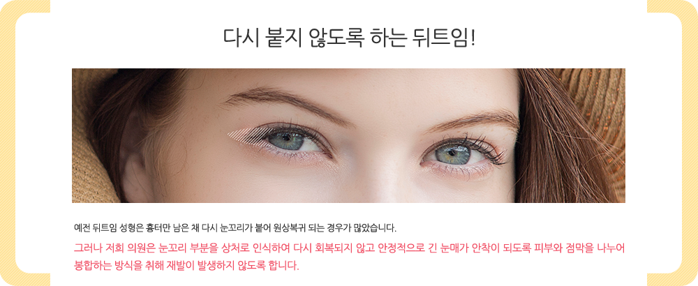 다시 붙지 않도록 하는 뒤트임! 예전 뒤트임 성형은 흉터만 남은 채 다시 눈꼬리가 붙어 원상복귀 되는 경우가 많았습니다. 그러나 저희 의원은 눈꼬리 부분을 상처로 인식하여 다시 회복되지 않고 안정적으로 긴 눈매가 안착이 되도록 피부와 점막을 나누어 봉합하는 방식을 취해 재발이 발생하지 않도록 합니다.