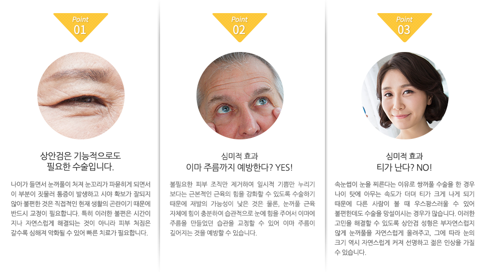 1.상안검은 기능적으로도
필요한 수술입니다. 나이가 들면서 눈꺼풀이 처져 눈꼬리가 파묻히게 되면서 이 부분이 짓물러 통증이 발생하고 시야 확보가 잘되지 않아 불편한 것은 직접적인 현재 생활의 곤란이기 때문에 반드시 교정이 필요합니다. 특히 이러한 불편은 시간이 지나 자연스럽게 해결되는 것이 아니라 피부 처짐은 갈수록 심해져 악화될 수 있어 빠른 치료가 필요합니다.
2. 심미적 효과
이마 주름까지 예방한다? YES! 불필요한 피부 조직만 제거하여 일시적 기쁨만 누리기 보다는 근본적인 근육의 힘을 강화할 수 있도록 수술하기 때문에 재발의 가능성이 낮은 것은 물론, 눈꺼풀 근육 자체에 힘이 충분하여 습관적으로 눈에 힘을 주어서 이마에 주름을 만들었던 습관을 교정할 수 있어 이마 주름이 깊어지는 것을 예방할 수 있습니다. 3. 심미적 효과
티가 난다? NO! 속눈썹이 눈을 찌른다는 이유로 쌍꺼풀 수술을 한 경우 나이 탓에 아무는 속도가 더뎌 티가 크게 나게 되기 때문에 다른 사람이 볼 때 우스꽝스러울 수 있어 불편한데도 수술을 망설이시는 경우가 많습니다. 이러한 고민을 해결할 수 있도록 상안검 성형은 부자연스럽지 않게 눈꺼풀을 자연스럽게 올려주고, 그에 따라 눈의 크기 역시 자연스럽게 커져 선명하고 젊은 인상을 가질 수 있습니다.