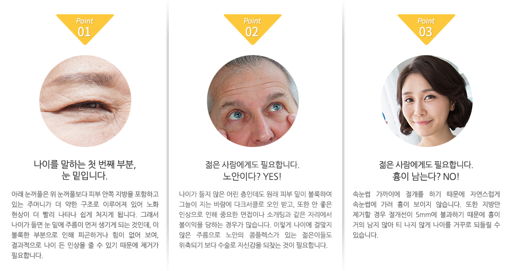 1.나이를 말하는 첫 번째 부분,
눈 밑입니다. 아래 눈꺼풀은 위 눈꺼풀보다 피부 안쪽 지방을 포함하고 있는 주머니가 더 약한 구조로 이루어져 있어 노화 현상이 더 빨리 나타나 쉽게 처지게 됩니다. 그래서 나이가 들면 눈 밑에 주름이 먼저 생기게 되는 것인데, 이 불룩한 부분으로 인해 피곤하거나 힘이 없어 보여, 결과적으로 나이 든 인상을 줄 수 있기 때문에 제거가 필요합니다. 2.젊은 사람에게도 필요합니다.
노안이다? YES! 나이가 들지 않은 어린 층인데도 원래 피부 밑이 불룩하여 그늘이 지는 바람에 다크서클로 오인 받고, 또한 안 좋은 인상으로 인해 중요한 면접이나 소개팅과 같은 자리에서 불이익을 당하는 경우가 많습니다. 이렇게 나이에 걸맞지 않은 주름으로 노안의 콤플렉스가 있는 젊은이들도 위축되기 보다 수술로 자신감을 되찾는 것이 필요합니다. 3.젊은 사람에게도 필요합니다.
흉이 남는다? NO! 속눈썹 가까이에 절개를 하기 때문에 자연스럽게 속눈썹에 가려 흉이 보이지 않습니다. 또한 지방만 제거할 경우 절개선이 5mm에 불과하기 때문에 흉이 거의 남지 않아 티 나지 않게 나이를 거꾸로 되돌릴 수 있습니다.