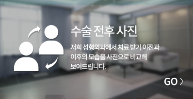 수술전후사진 바로가기