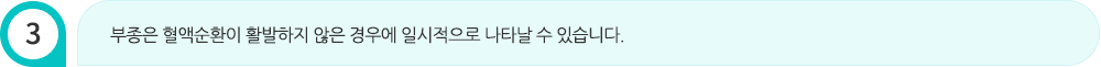 부종은 혈액순환이 활발하지 않은 경우에 일시적으로 나타날 수 있습니다.