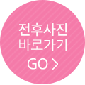 전후사진 바로가기GO