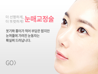 눈매교정술 바로가기