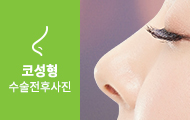코성형