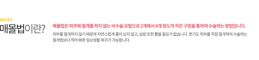 매몰법이란? 매몰법은 피부에 절개를 하지 않는 비수술 요법으로 2개에서 4개 정도의 작은 구멍을 통하여 수술하는 방법입니다. 피부를 절개하지 않기 때문에 자연스럽게 흉이 남지 않고, 실밥 또한 뽑을 필요가 없습니다. 붓기도 피부를 직접 절개하여 수술하는 절개법보다 적어 빠른 일상생활 복귀가 가능합니다.