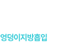 엉덩이지방흡입