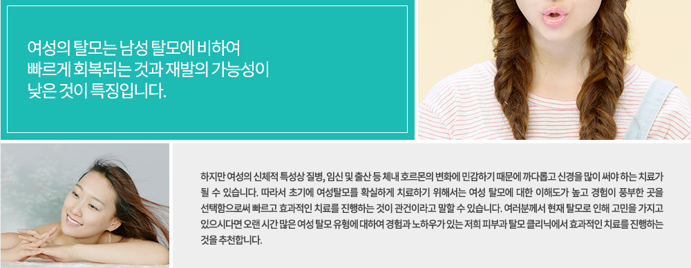여성의 탈모는 남성 탈모에 비하여 빠르게 회복되는 것과 재발의 가능성이 낮은 것이 특징입니다.
하지만 여성의 신체적 특성상 질병, 임신 및 출산 등 체내 호르몬의 변화에 민감하기 때문에 까다롭고 신경을 많이 써야 하는 치료가 될 수 있습니다. 따라서 초기에 여성탈모를 확실하게 치료하기 위해서는 여성 탈모에 대한 이해도가 높고 경험이 풍부한 곳을 선택함으로써 빠르고 효과적인 치료를 진행하는 것이 관건이라고 말할 수 있습니다. 여러분께서 현재 탈모로 인해 고민을 가지고 있으시다면 오랜 시간 많은 여성 탈모 유형에 대하여 경험과 노하우가 있는 저희 피부과 탈모 클리닉에서 효과적인 치료를 진행하는 것을 추천합니다.
