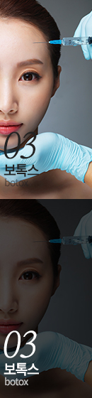 보톡스