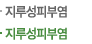 지루성피부염