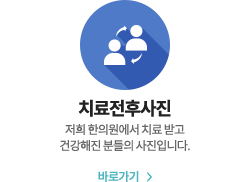 치료전후사진 바로가기