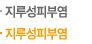 지루성피부염