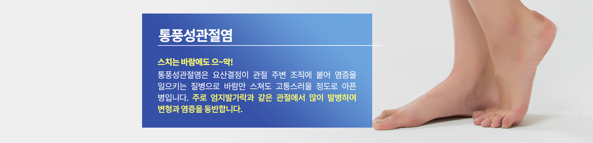 통풍성