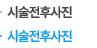 시술전후사진