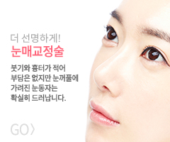 눈매교정술 바로가기