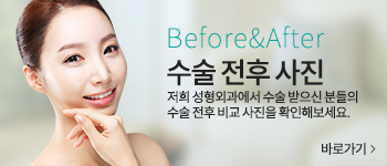 수술전후사진