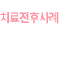 치료전후사례